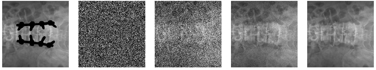 Iterative denoising process for X-ray inpainting